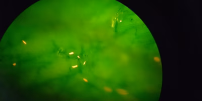 海苔の育苗記②｜海苔の赤ちゃんの健康診断「検鏡」ばい